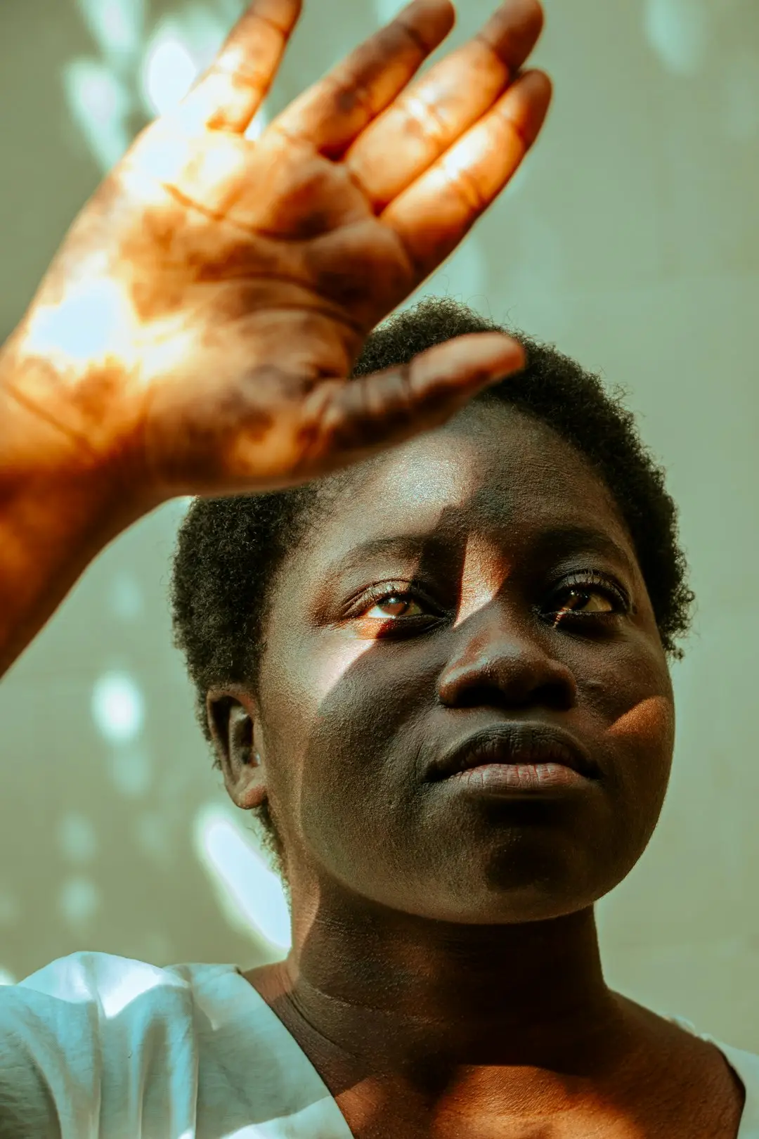 Melasma: o cuidado diário que faz diferença